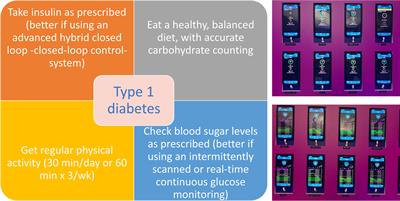 Editorial: Conditions and results of effective glycemic control in children with type 1 diabetes